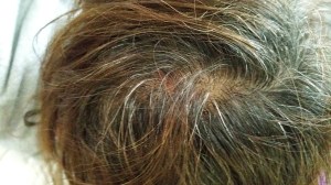 Ouch! Can you see the red?