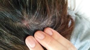 See?! Oooh it hurts!